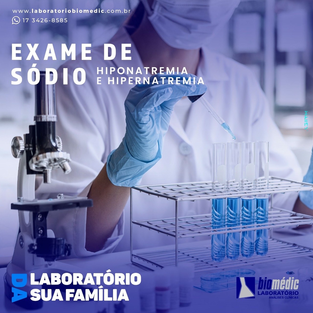 Laboratório Biomédic - Exame de sódio